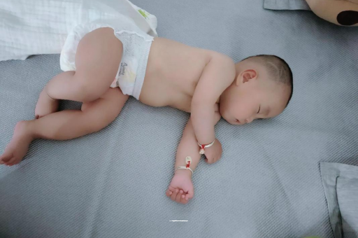 昌吉六个月宝宝眼睛散光